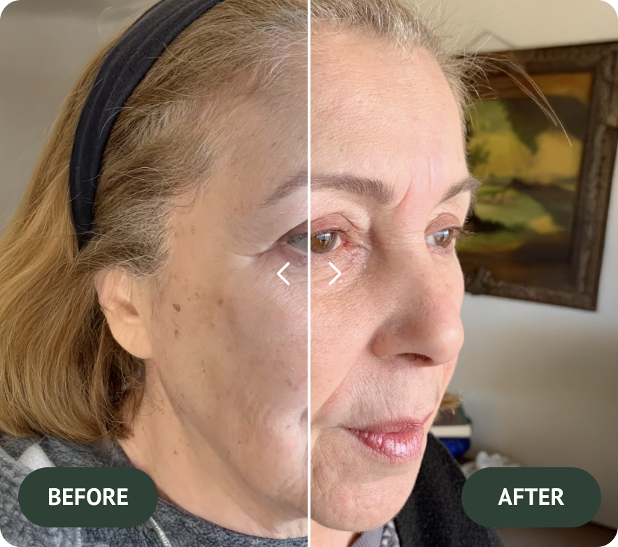 After treatment