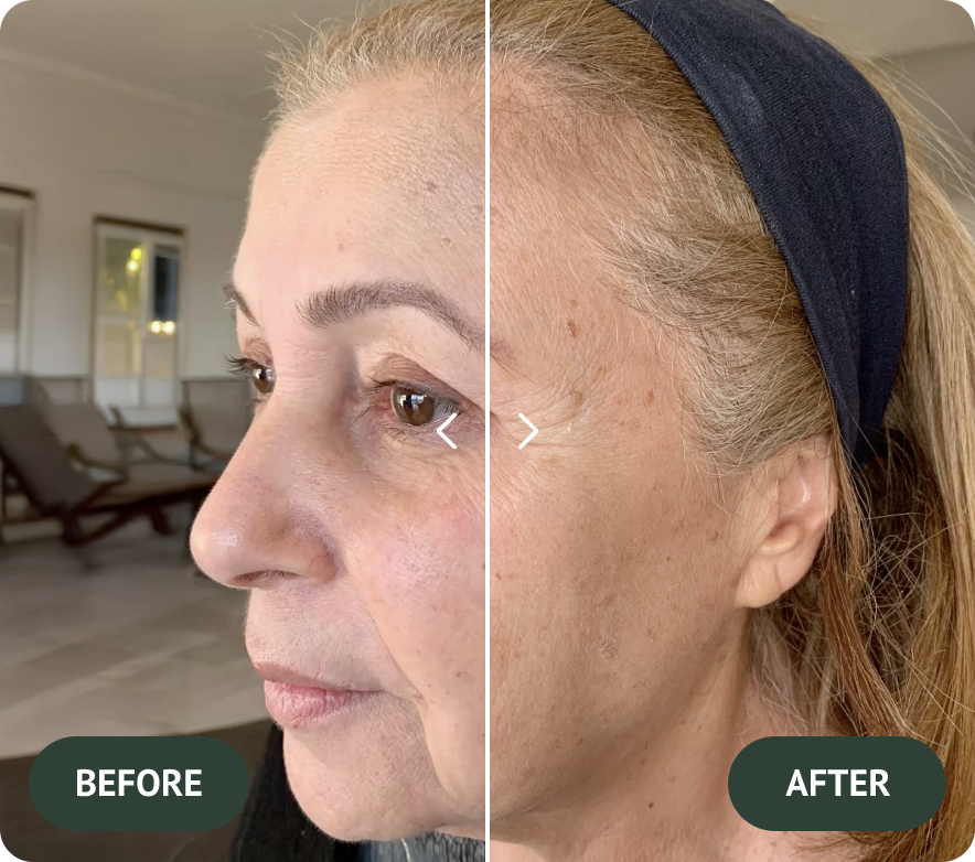 After treatment