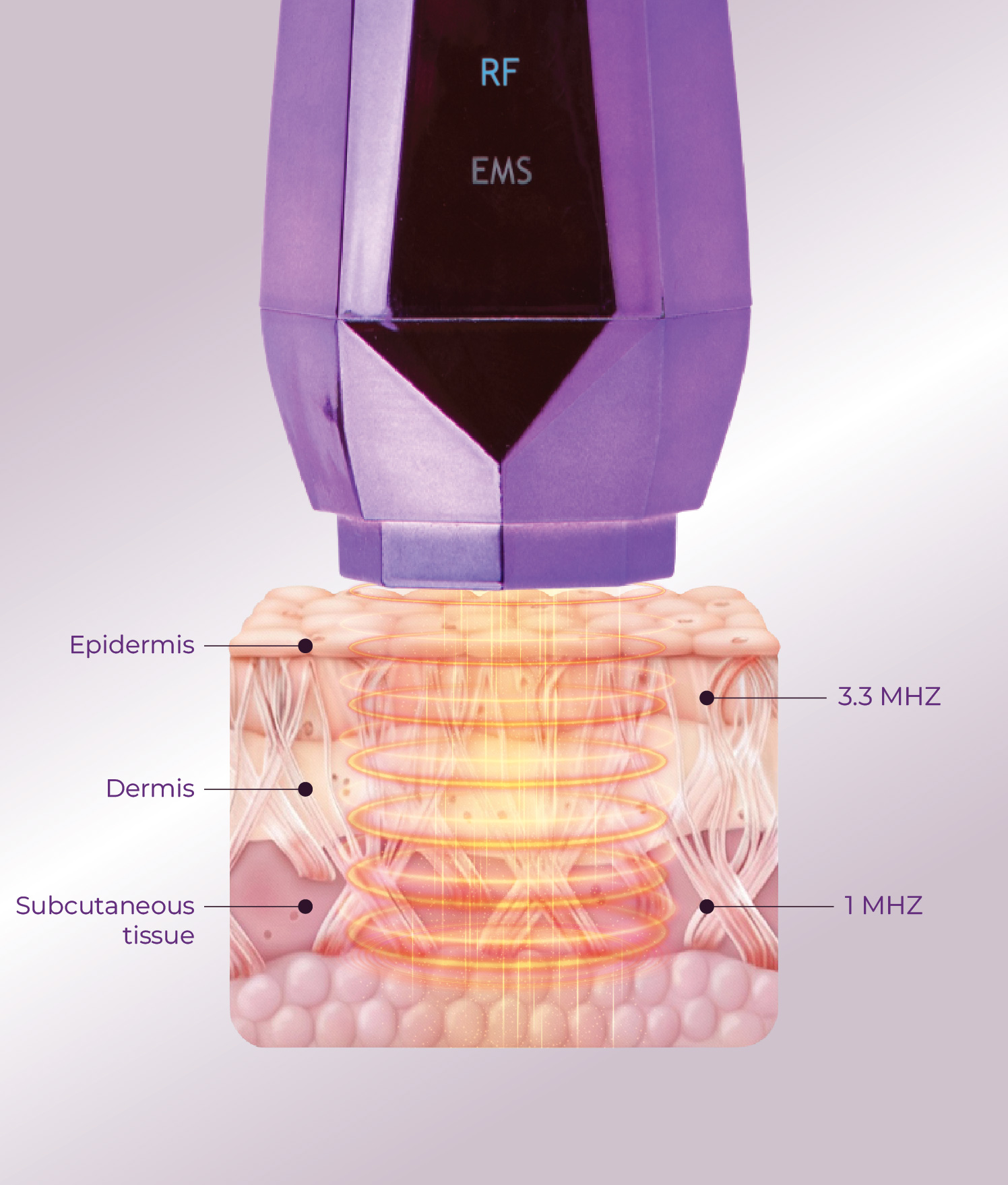 RF Technology device